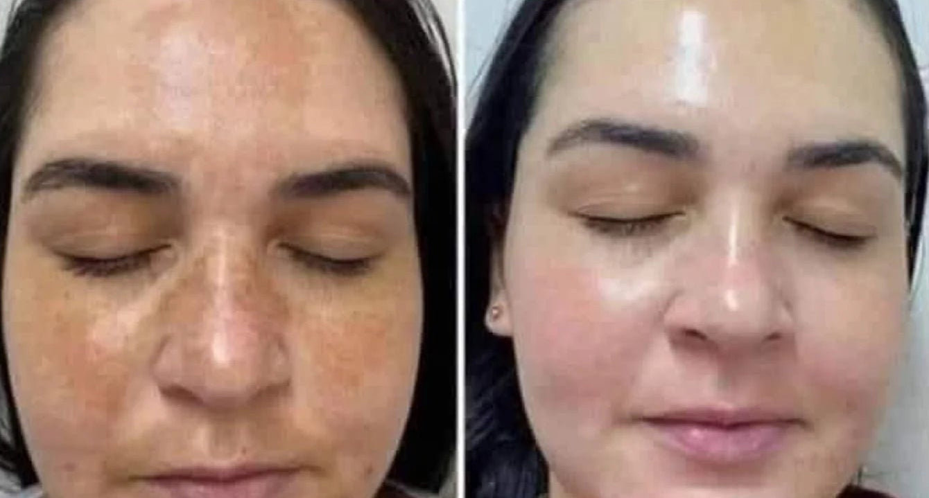 Collage of blue powder, blue stones, and a before-and-after comparison of a woman's face.