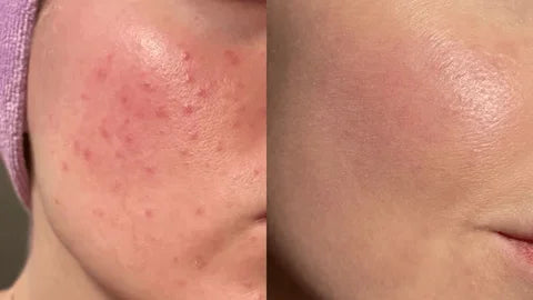 Pure Moroccan Argan Oil – Organic Cold-Pressed - زيت الأرجان المغربي الأصلي