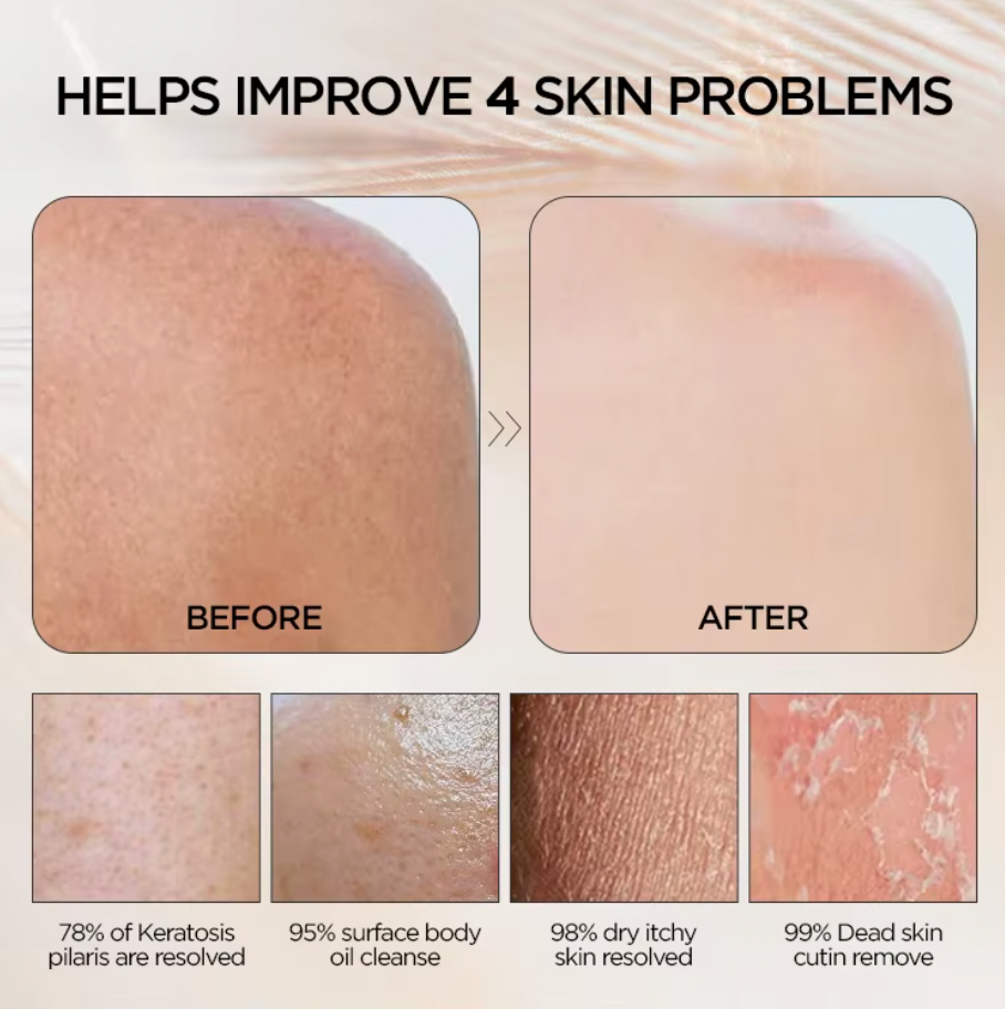 Before and after comparison of skin problems with text indicating improvement rates using kessa gloves