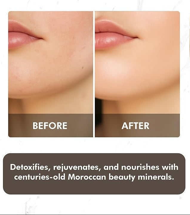Rhassoul clay packaging with 'Before' and 'After' skin comparison on a white background