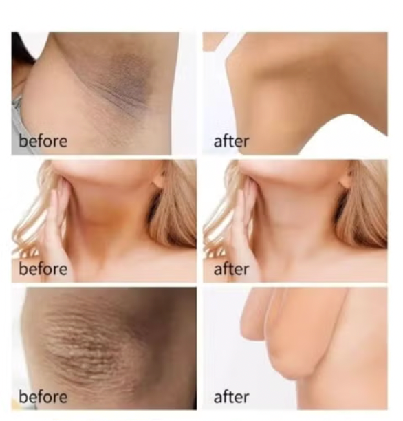 Kenta Cream - كريم كينتا