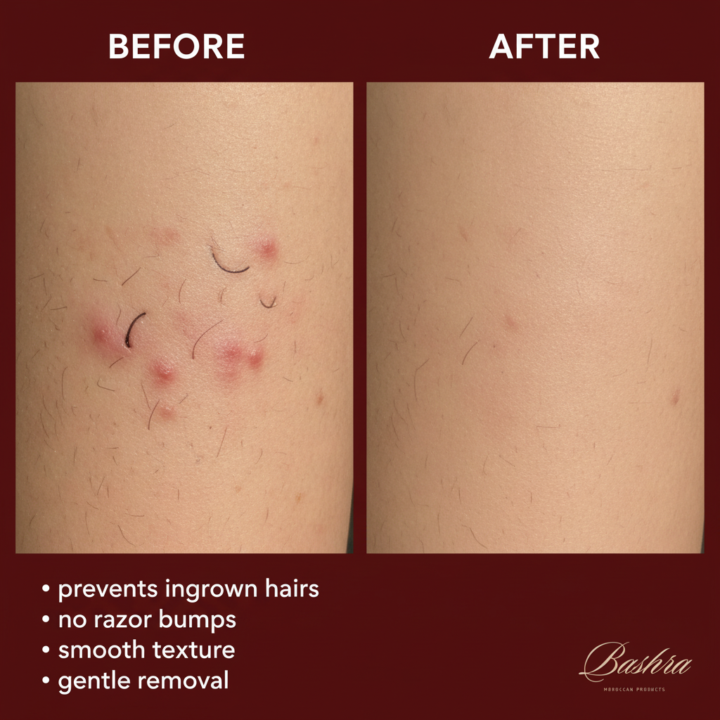 Ingrown hairs before after Bashra Halawa sugaring - prevents ingrown hairs razor bumps, smooth clear skin, no bumps, gentle natural hair removal